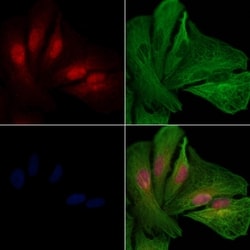 Invitrogen UBE2M Polyclonal Antibody 100 &mu;L; Unconjugated:Antibodies,