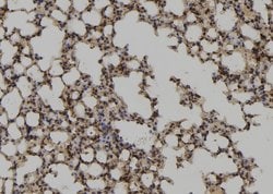 Invitrogen UBE2M Polyclonal Antibody 100 &mu;L; Unconjugated:Antibodies,