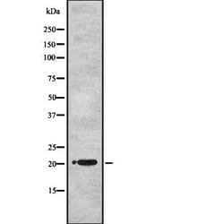 Invitrogen UBE2M Polyclonal Antibody 100 &mu;L; Unconjugated:Antibodies,