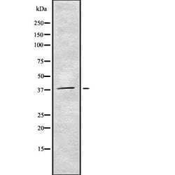 Invitrogen CDC123 Polyclonal Antibody 100 &mu;L | Buy Online | Invitrogen&trade; | Fisher Scientific