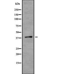 Invitrogen TMOD2 Polyclonal Antibody 100 &mu;L; Unconjugated:Antibodies,
