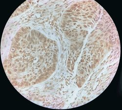 Invitrogen S100P Polyclonal Antibody 100 &mu;L; Unconjugated:Antibodies,