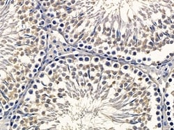 Invitrogen KAP3 Polyclonal Antibody 100 &mu;L; Unconjugated:Antibodies,