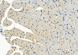 Invitrogen MYL4 Polyclonal Antibody 100 &mu;L; Unconjugated:Antibodies,