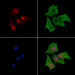 Invitrogen PKP3 Polyclonal Antibody 100 &mu;L; Unconjugated:Antibodies,