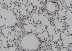 Invitrogen PKP3 Polyclonal Antibody 100 &mu;L; Unconjugated:Antibodies,