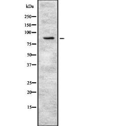 Invitrogen PKP3 Polyclonal Antibody 100 &mu;L; Unconjugated:Antibodies,