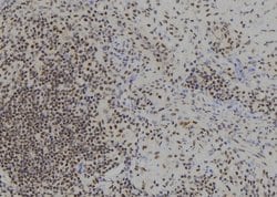 Invitrogen BACH1 Polyclonal Antibody 100 &mu;L | Buy Online | Invitrogen&trade; | Fisher Scientific