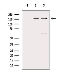 Invitrogen BACH1 Polyclonal Antibody 100 &mu;L | Buy Online | Invitrogen&trade; | Fisher Scientific