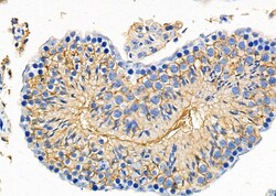 Invitrogen GDF1 Polyclonal Antibody 100 &mu;L; Unconjugated:Antibodies,
