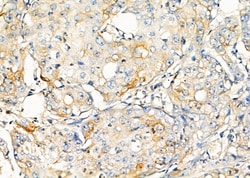 Invitrogen REM1 Polyclonal Antibody 100 &mu;L; Unconjugated:Antibodies,