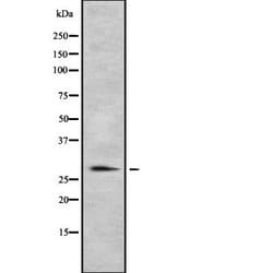 Invitrogen HLA-DR/DP Polyclonal Antibody 100 &mu;L; Unconjugated:Antibodies,