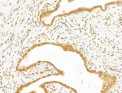 Invitrogen MCRS1 Polyclonal Antibody 100 &mu;L | Buy Online | Invitrogen&trade; | Fisher Scientific