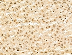 Invitrogen MCRS1 Polyclonal Antibody 100 &mu;L | Buy Online | Invitrogen&trade; | Fisher Scientific