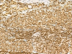 Invitrogen MCRS1 Polyclonal Antibody 100 &mu;L | Buy Online | Invitrogen&trade; | Fisher Scientific