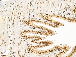 Invitrogen MCRS1 Polyclonal Antibody 100 &mu;L | Buy Online | Invitrogen&trade; | Fisher Scientific