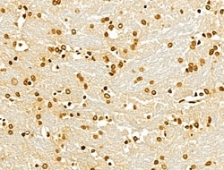 Invitrogen MCRS1 Polyclonal Antibody 100 &mu;L | Buy Online | Invitrogen&trade; | Fisher Scientific