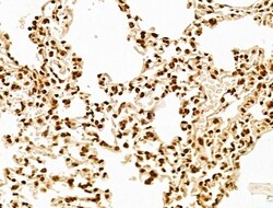 Invitrogen MCRS1 Polyclonal Antibody 100 &mu;L | Buy Online | Invitrogen&trade; | Fisher Scientific