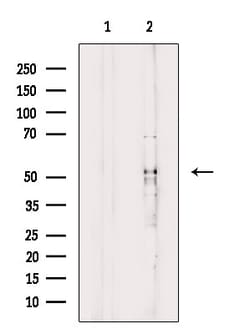 Invitrogen MCRS1 Polyclonal Antibody 100 &mu;L | Buy Online | Invitrogen&trade; | Fisher Scientific