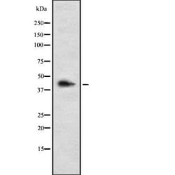 Invitrogen LHX3 Polyclonal Antibody 100 &mu;L; Unconjugated:Antibodies,