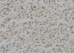 Invitrogen WRN Polyclonal Antibody 100 &mu;L; Unconjugated:Antibodies,