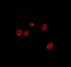 Invitrogen SENP2 Polyclonal Antibody 100 &mu;L; Unconjugated:Antibodies,