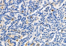 Invitrogen SENP2 Polyclonal Antibody 100 &mu;L; Unconjugated:Antibodies,