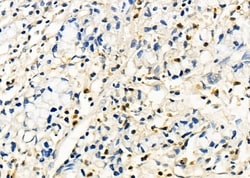 Invitrogen CSN7b Polyclonal Antibody 100 &mu;L | Buy Online | Invitrogen&trade; | Fisher Scientific