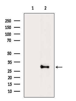Invitrogen CSN7b Polyclonal Antibody 100 &mu;L | Buy Online | Invitrogen&trade; | Fisher Scientific