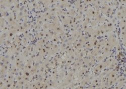 Invitrogen CSN7b Polyclonal Antibody 100 &mu;L | Buy Online | Invitrogen&trade; | Fisher Scientific