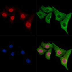 Invitrogen FUS Polyclonal Antibody 100 &mu;L; Unconjugated:Antibodies,