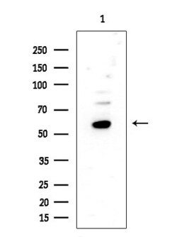 Invitrogen FUS Polyclonal Antibody 100 &mu;L; Unconjugated:Antibodies,