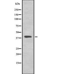 Invitrogen TMEFF2 Polyclonal Antibody 100 &mu;L | Buy Online | Invitrogen&trade; | Fisher Scientific