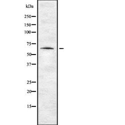 Invitrogen ENC1 Polyclonal Antibody 100 &mu;L; Unconjugated:Antibodies,