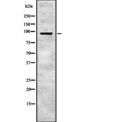 EPS8 Polyclonal Antibody:Antibodies, Polyclonal