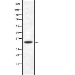 Invitrogen CD275 (B7-H2) Polyclonal Antibody 100 &mu;L; Unconjugated:Antibodies,
