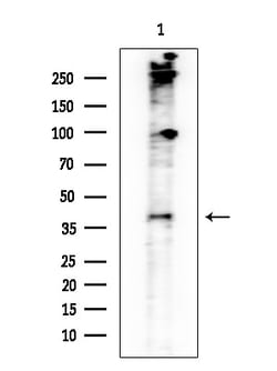 Invitrogen LIPF Polyclonal Antibody 100 &mu;L; Unconjugated:Antibodies,