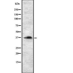 Invitrogen RASSF2 Polyclonal Antibody 100 &mu;L; Unconjugated:Antibodies,