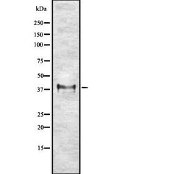 Invitrogen ETV2 Polyclonal Antibody 100 &mu;L | Buy Online | Invitrogen&trade; | Fisher Scientific