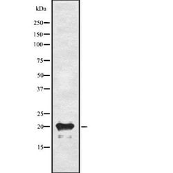 Invitrogen Adrenomedullin Polyclonal Antibody 100 &mu;L; Unconjugated:Antibodies,