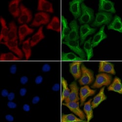 Invitrogen Ameloblastin Polyclonal Antibody 100 &mu;L; Unconjugated:Antibodies,