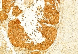 Invitrogen Ameloblastin Polyclonal Antibody 100 &mu;L; Unconjugated:Antibodies,