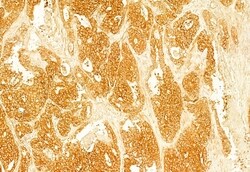 Invitrogen Ameloblastin Polyclonal Antibody 100 &mu;L; Unconjugated:Antibodies,