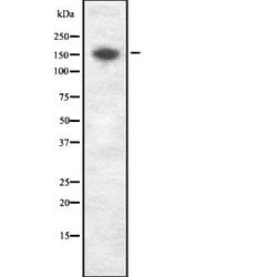 Invitrogen ATP7A Polyclonal Antibody 100 &mu;L; Unconjugated:Antibodies,