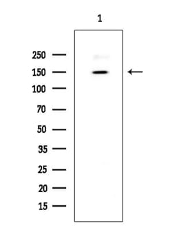Invitrogen BRCAA1 Polyclonal Antibody 100 &mu;L; Unconjugated:Antibodies,