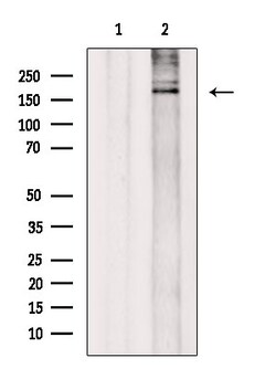 Invitrogen SMARCA2 Polyclonal Antibody 100 &mu;L | Buy Online | Invitrogen&trade; | Fisher Scientific