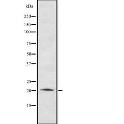 Invitrogen Cardiotrophin 1 Polyclonal Antibody 100 &mu;L; Unconjugated:Antibodies,