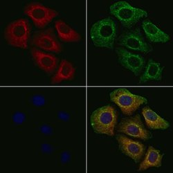 Invitrogen CTPS Polyclonal Antibody 100 &mu;L; Unconjugated:Antibodies,