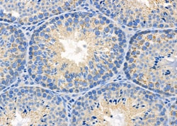 Invitrogen CTPS Polyclonal Antibody 100 &mu;L; Unconjugated:Antibodies,