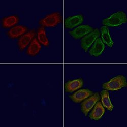 beta-2 Defensin Polyclonal Antibody:Antibodies, Polyclonal